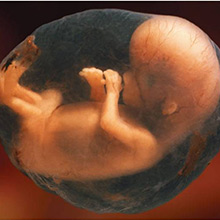 fetusinwomb1